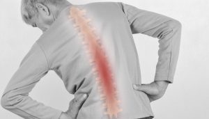 Degenerative Disc Disease