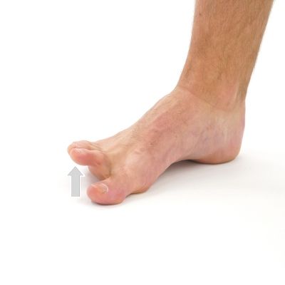 Plantar Fasciitis Exercises - Moriarty PT